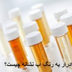 ادرار به رنگ آب نشانه چیست؟ علت ادرار بی رنگ و شفاف چیست؟
