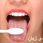 علت سفیدی زبان در نوزاد و بزرگسالان چیست؟ + درمان سفیدی زبان