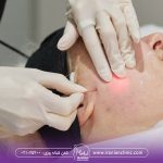 قیمت اندولیفت در تهران چقدر است؟