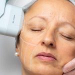 عوارض هایفوتراپی صورت تا چه اندازه خطرناک است؟