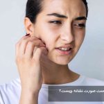 خارش پوست صورت نشانه چیست؟ درمان دارویی و خانگی خارش پوست صورت