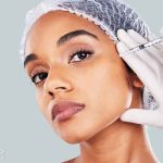 کربوکسی تراپی در فیشیال چگونه است؟ – مجله سلامت دکترتو